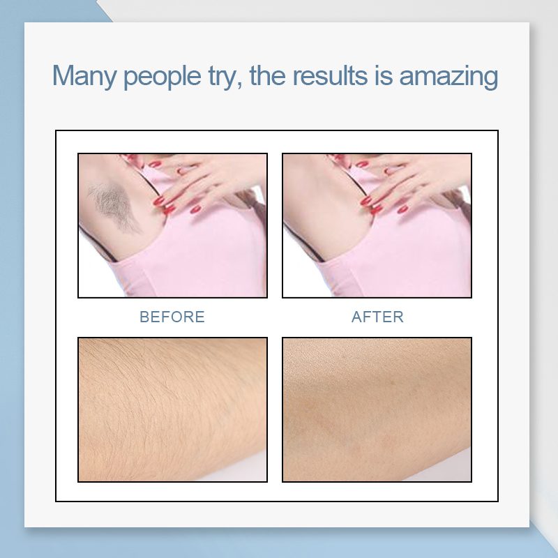 ROSALIND Hair Removal Cream Underarm Hand Leg Body Painless Effective depiladora Facial Hair Remover Lightening Smooth Care ROSALIND Hair Removal Cream Underarm Hand Leg Body Painless Effective depiladora Facial Hair Remover Lightening Smooth Care
