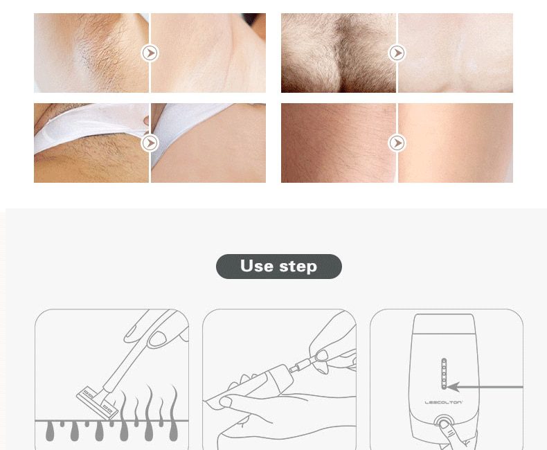 Lescolton 3in1 700000 pulsed IPL Laser Hair Removal Device Permanent Hair Removal IPL laser Epilator Armpit Hair Removal machine Lescolton 3in1 700000 pulsed IPL Laser Hair Removal Device Permanent Hair Removal IPL laser Epilator Armpit Hair Removal machine