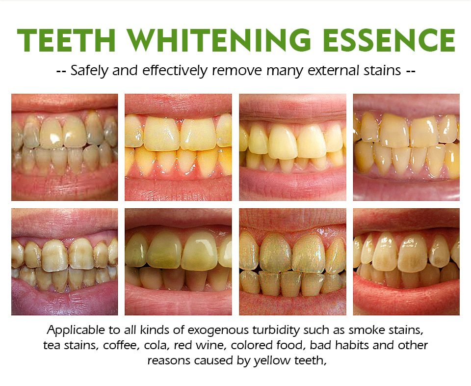 VIBRANT GLAMOUR Teeth Whitening Pen Cleaning Serum Remove Plaque Stains Dental Tools Oral Hygiene Tooth Gel WhitenningToothpaste