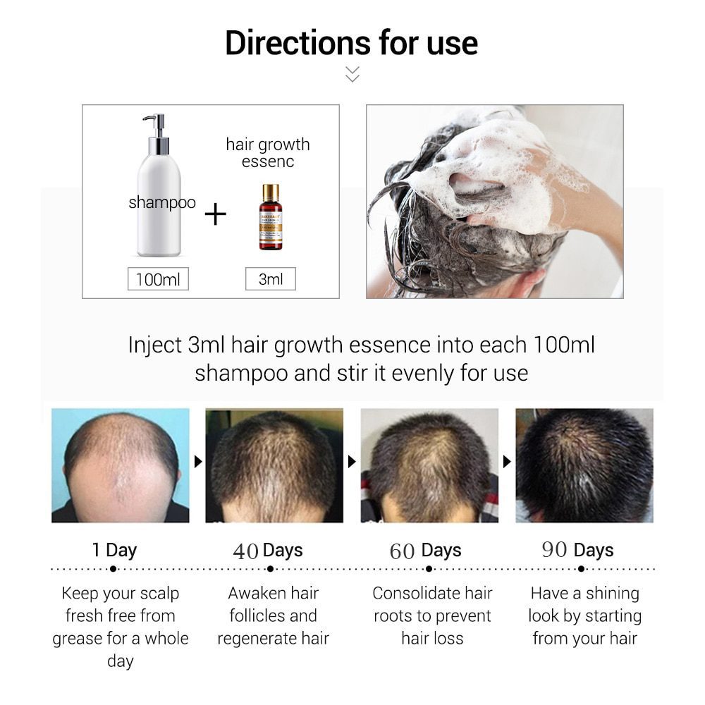 Hair Care Hair Growth Essential Oils Essence Original Authentic 100% Hair Loss Liquid Health Care Beauty Dense Hair Growth Serum Hair Care Hair Growth Essential Oils Essence Original Authentic 100% Hair Loss Liquid Health Care Beauty Dense Hair Growth Serum
