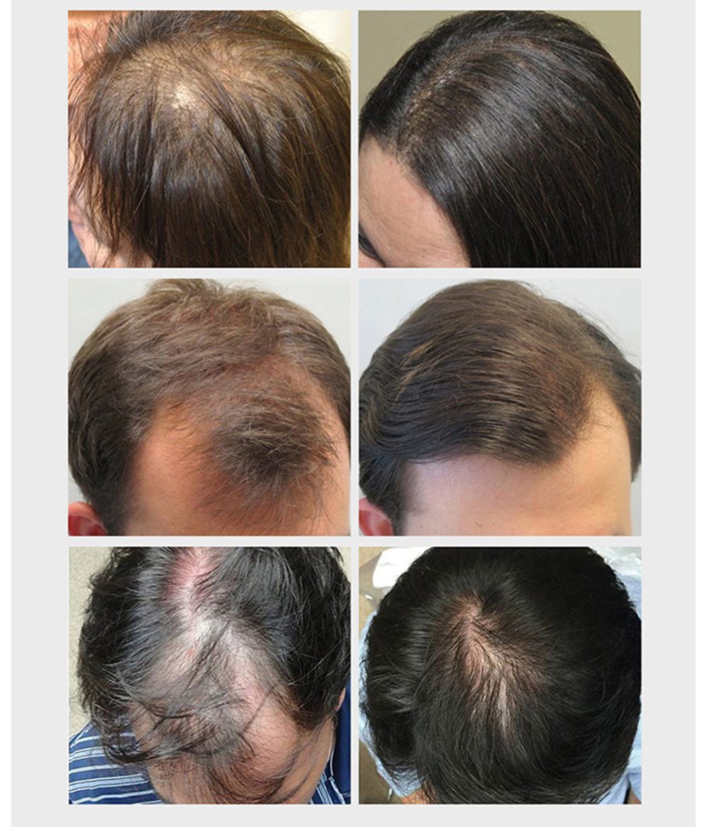 Hair Care Hair Growth Essential Oils Essence Original Authentic 100% Hair Loss Liquid Health Care Beauty Dense Hair Growth Serum Hair Care Hair Growth Essential Oils Essence Original Authentic 100% Hair Loss Liquid Health Care Beauty Dense Hair Growth Serum