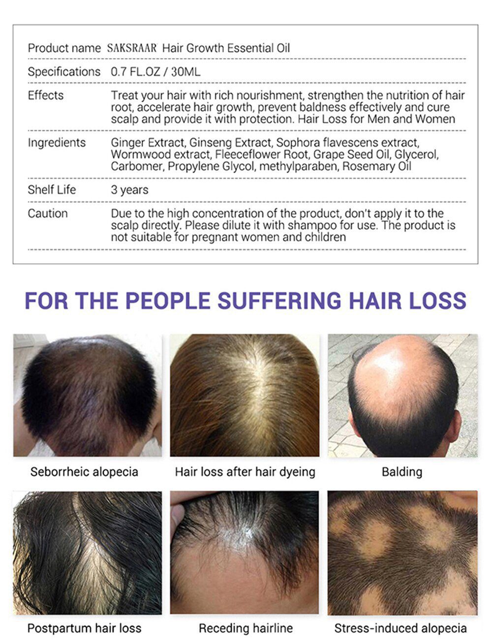 Hair Care Hair Growth Essential Oils Essence Original Authentic 100% Hair Loss Liquid Health Care Beauty Dense Hair Growth Serum Hair Care Hair Growth Essential Oils Essence Original Authentic 100% Hair Loss Liquid Health Care Beauty Dense Hair Growth Serum