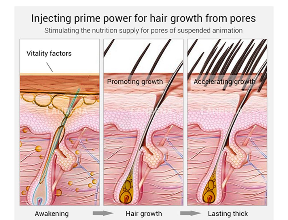 Hair Care Hair Growth Essential Oils Essence Original Authentic 100% Hair Loss Liquid Health Care Beauty Dense Hair Growth Serum Hair Care Hair Growth Essential Oils Essence Original Authentic 100% Hair Loss Liquid Health Care Beauty Dense Hair Growth Serum