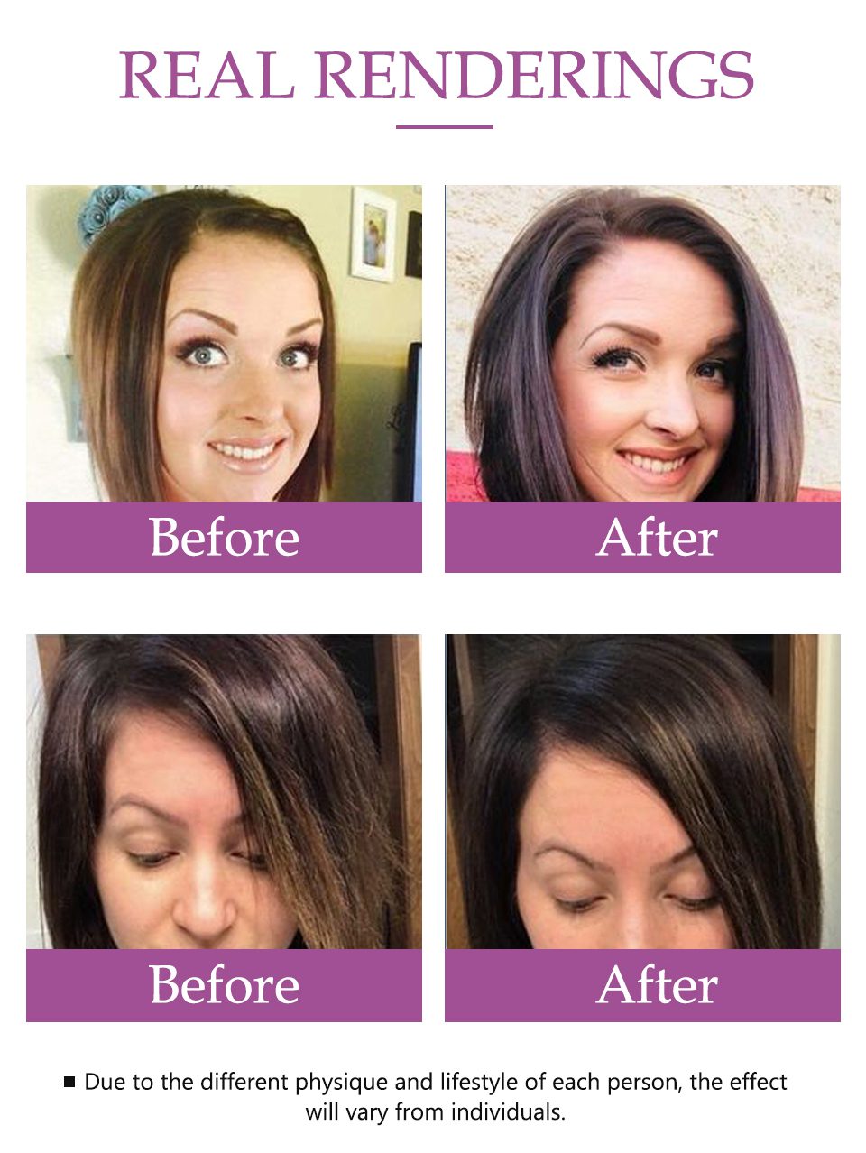 Hair Growth Treatment Oil for Anti Hair Loss Essence Fast Thick Hair Eyebrows Support Natural Healthy Hair Treatment for Women Hair Growth Treatment Oil for Anti Hair Loss Essence Fast Thick Hair Eyebrows Support Natural Healthy Hair Treatment for Women