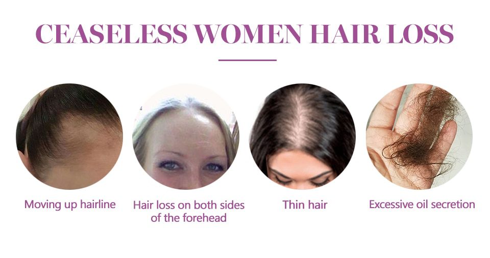 Hair Growth Treatment Oil for Anti Hair Loss Essence Fast Thick Hair Eyebrows Support Natural Healthy Hair Treatment for Women Hair Growth Treatment Oil for Anti Hair Loss Essence Fast Thick Hair Eyebrows Support Natural Healthy Hair Treatment for Women