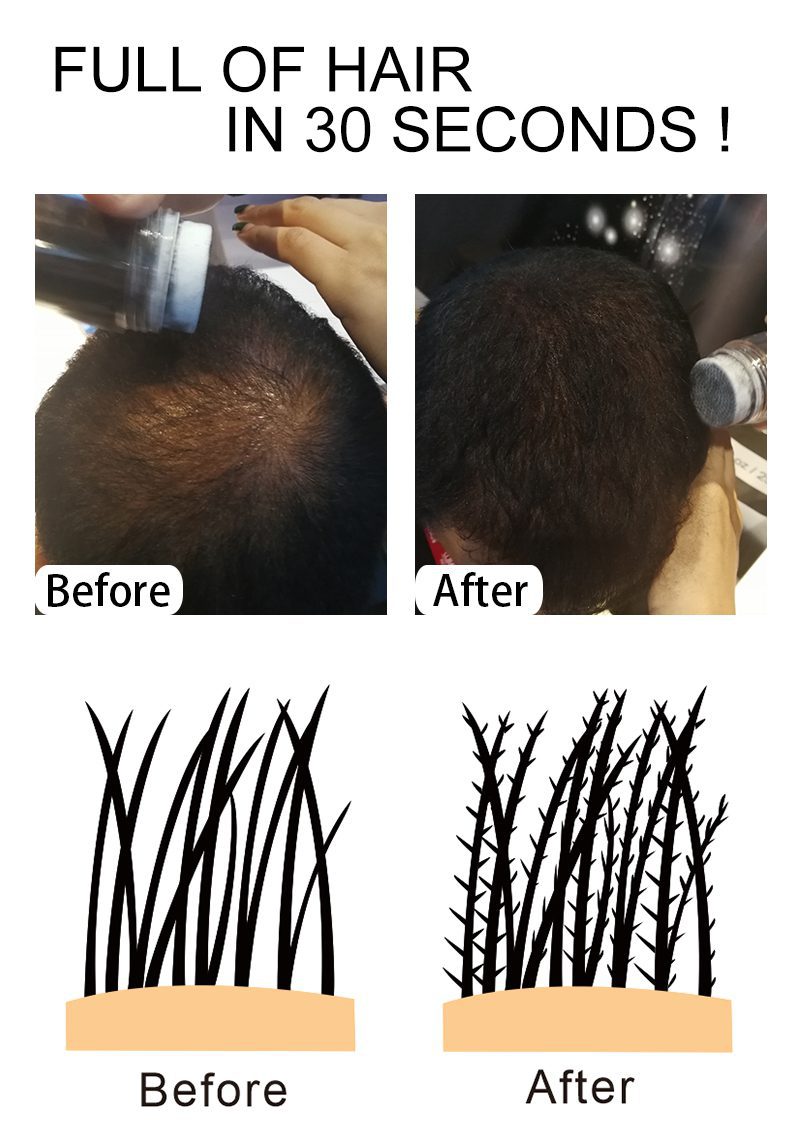 Sevich 25g hair building fibers powder hair loss products bald extension thicken hair spray jar keratin Sevich 25g hair building fibers powder hair loss products bald extension thicken hair spray jar keratin