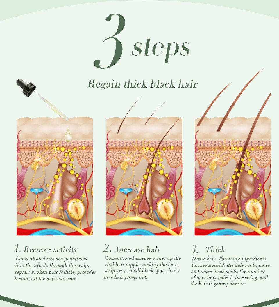 Hair Growth Essence Oil Anti Hair Loss Treatment for Hair Growth Hair Care Anti Preventing Hair Loss Products Hair Tonic Hair Growth Essence Oil Anti Hair Loss Treatment for Hair Growth Hair Care Anti Preventing Hair Loss Products Hair Tonic