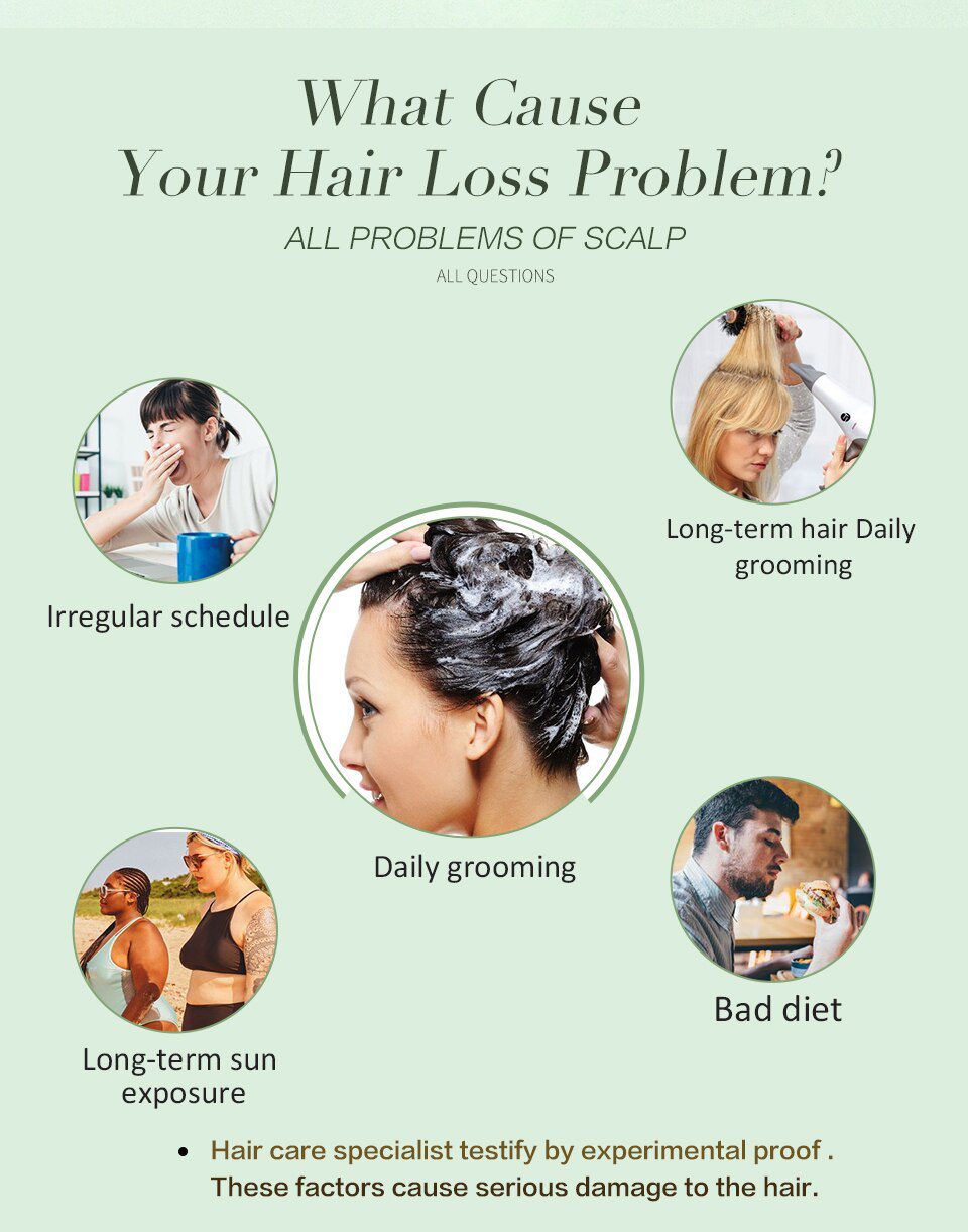 Hair Growth Essence Oil Anti Hair Loss Treatment for Hair Growth Hair Care Anti Preventing Hair Loss Products Hair Tonic Hair Growth Essence Oil Anti Hair Loss Treatment for Hair Growth Hair Care Anti Preventing Hair Loss Products Hair Tonic