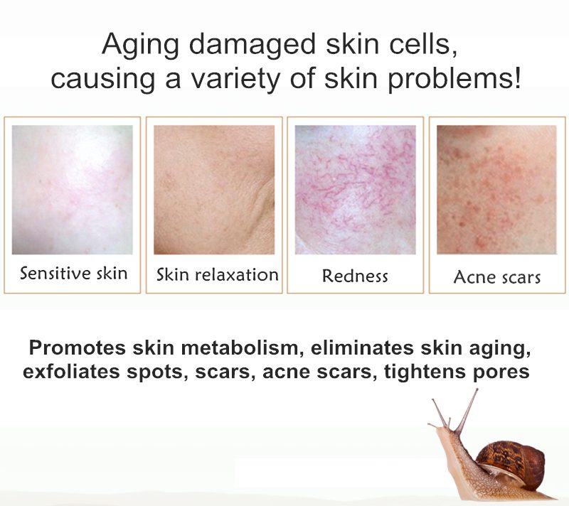 Dimollaure 30g pure Kojic Acid whitening cream+Kojic Acid serum Wrinkle removal Freckle melasma Acne scar pigmentt melanin cream Dimollaure 30g pure Kojic Acid whitening cream+Kojic Acid serum Wrinkle removal Freckle melasma Acne scar pigmentt melanin cream