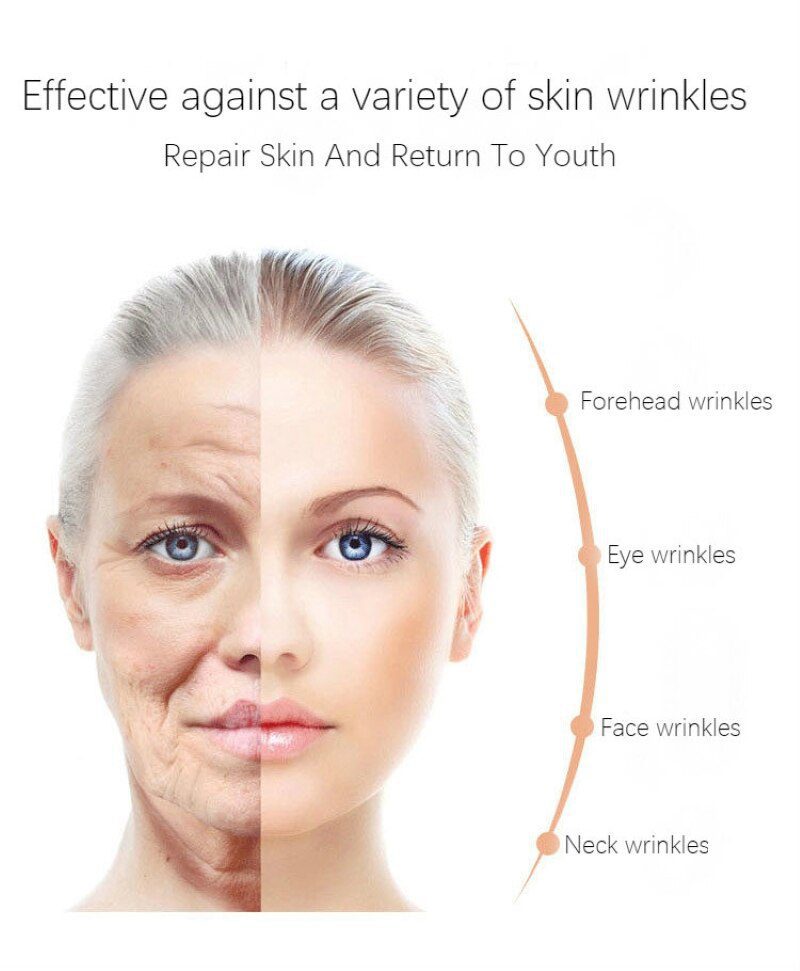 Dimollaure whitening Freckle cream+Fullerene 24k Gold Serum Anti-aging wrinkle Serum Removal melasma sunburn brown spot melanin Dimollaure whitening Freckle cream+Fullerene 24k Gold Serum Anti-aging wrinkle Serum Removal melasma sunburn brown spot melanin