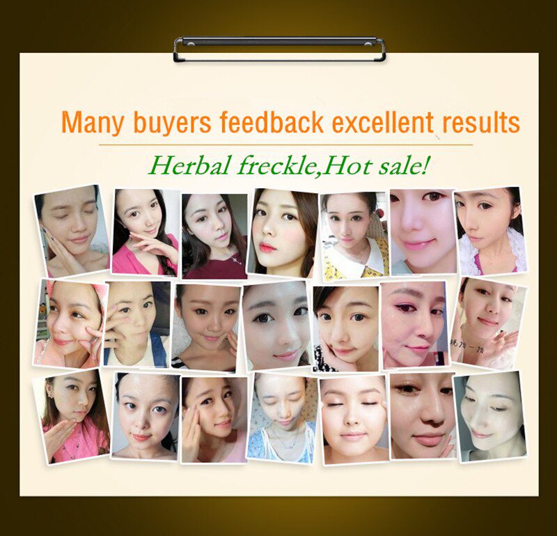 Dimollaure 30g pure Kojic Acid whitening cream+Vitamin C serum removal Acne Pimples Anti Aging pigmentt melanin Wrinkle cream Dimollaure 30g pure Kojic Acid whitening cream+Vitamin C serum removal Acne Pimples Anti Aging pigmentt melanin Wrinkle cream