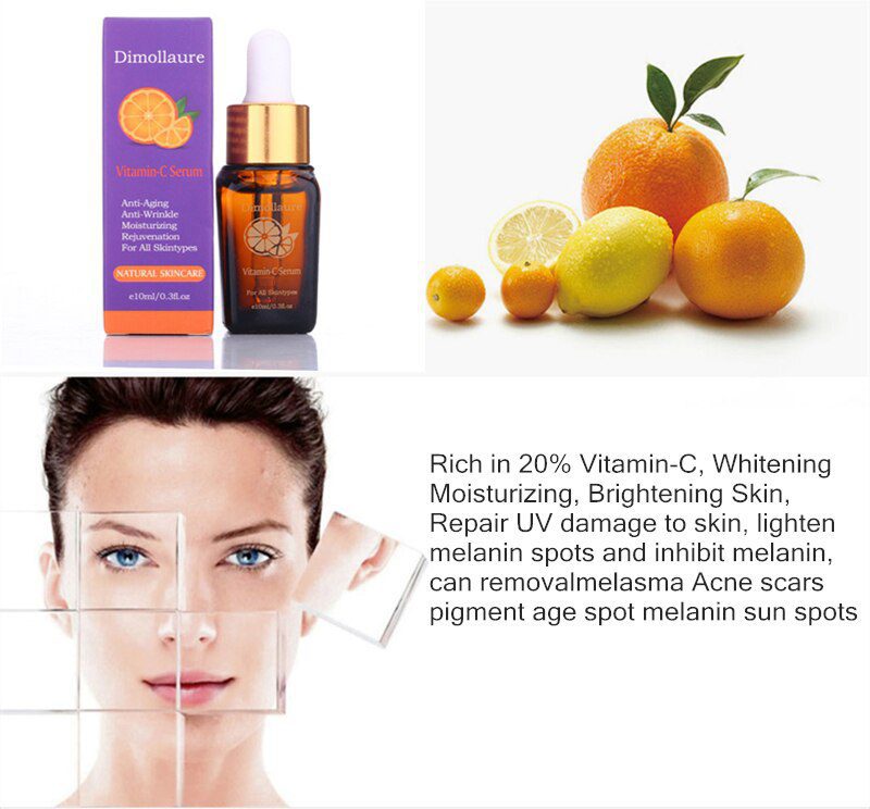 Dimollaure Retinol whitening face cream +Vitamin C serum Acne treament Remove Freckle melasma pigment Melanin sunburn Spots Dimollaure Retinol whitening face cream +Vitamin C serum Acne treament Remove Freckle melasma pigment Melanin sunburn Spots