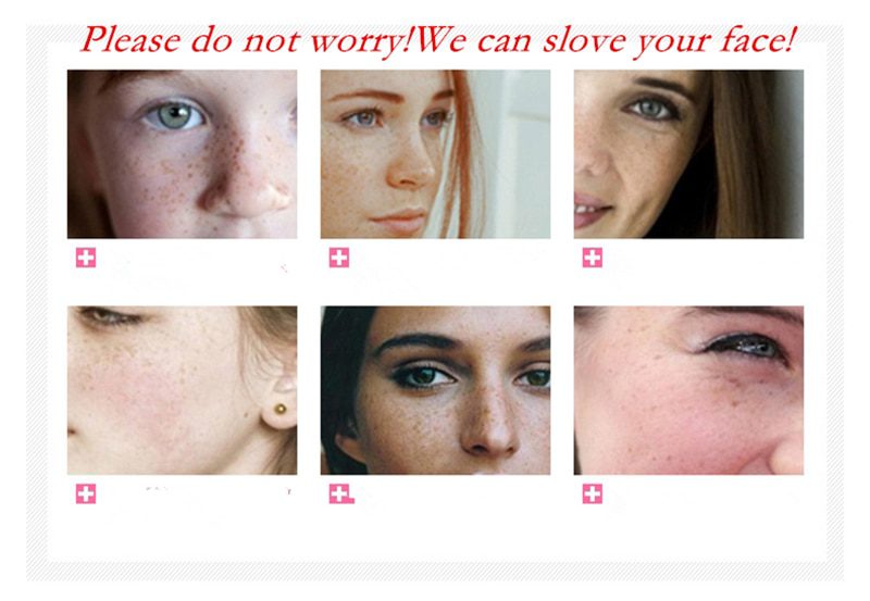 Dimollaure Retinol whitening cream +Kojic acid serum Remove Freckle melasma pigment Melanin sunburn Acne scars brown Spot Dimollaure Retinol whitening cream +Kojic acid serum Remove Freckle melasma pigment Melanin sunburn Acne scars brown Spot