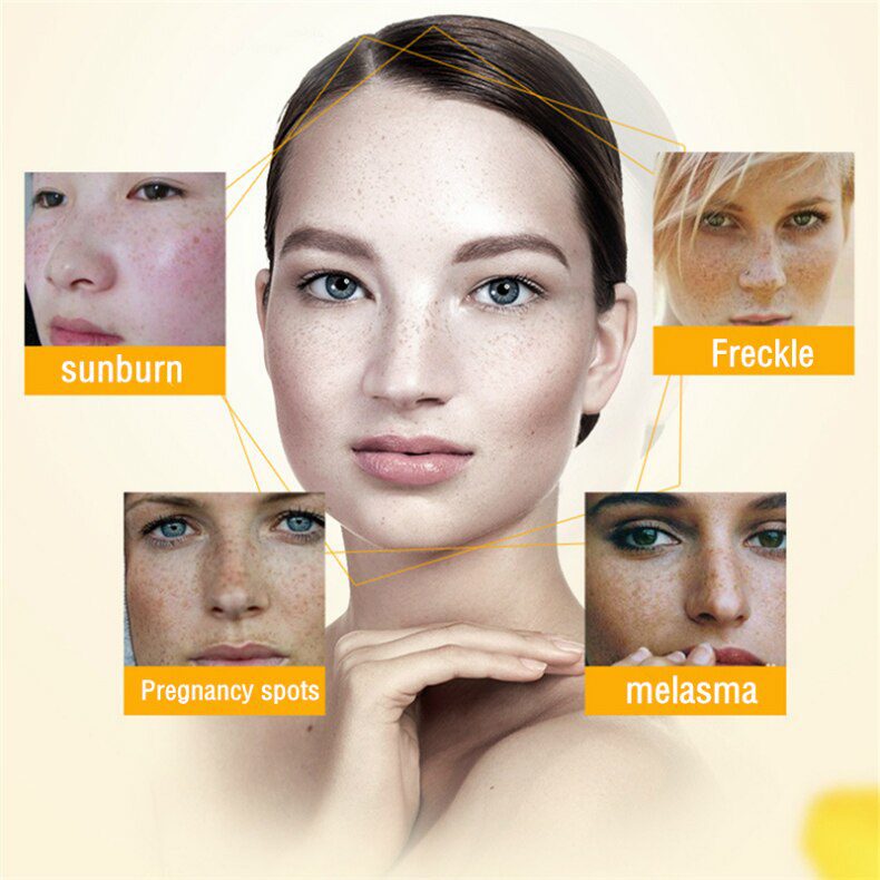 Dimollaure Retinol Cream Whitening Moisturizing kojic acid serum Remove Freckle melasma Melanin sunburn Acne scar dark Spot Dimollaure Retinol Cream Whitening Moisturizing kojic acid serum Remove Freckle melasma Melanin sunburn Acne scar dark Spot