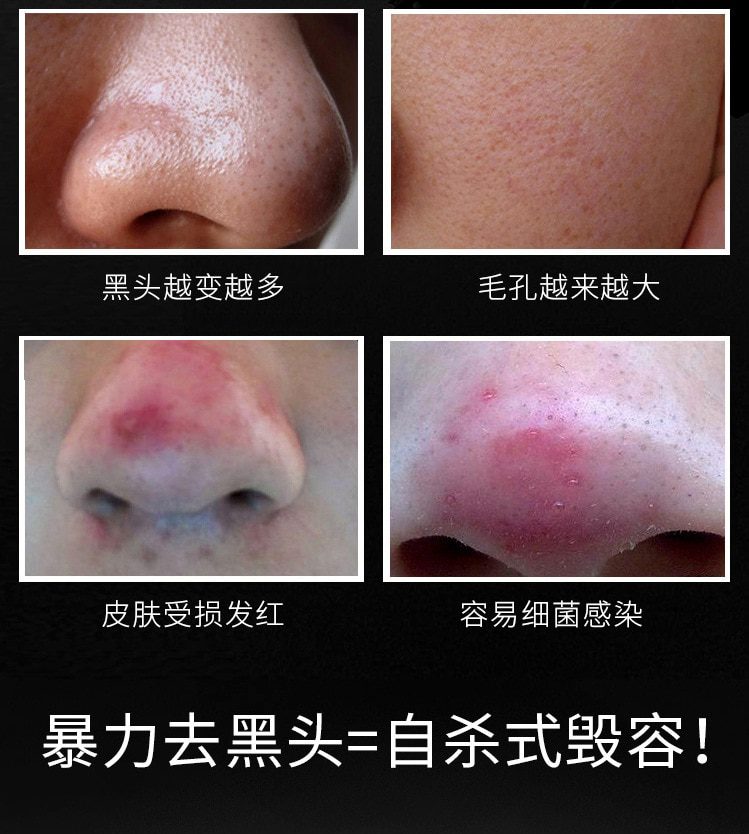 1 Pcs Sell Bamboo Charcoal Blackhead Remove Facial Masks Deep Cleansing Purifying Peel Off Black Nud Facail Face Masks 1 Pcs Sell Bamboo Charcoal Blackhead Remove Facial Masks Deep Cleansing Purifying Peel Off Black Nud Facail Face Masks