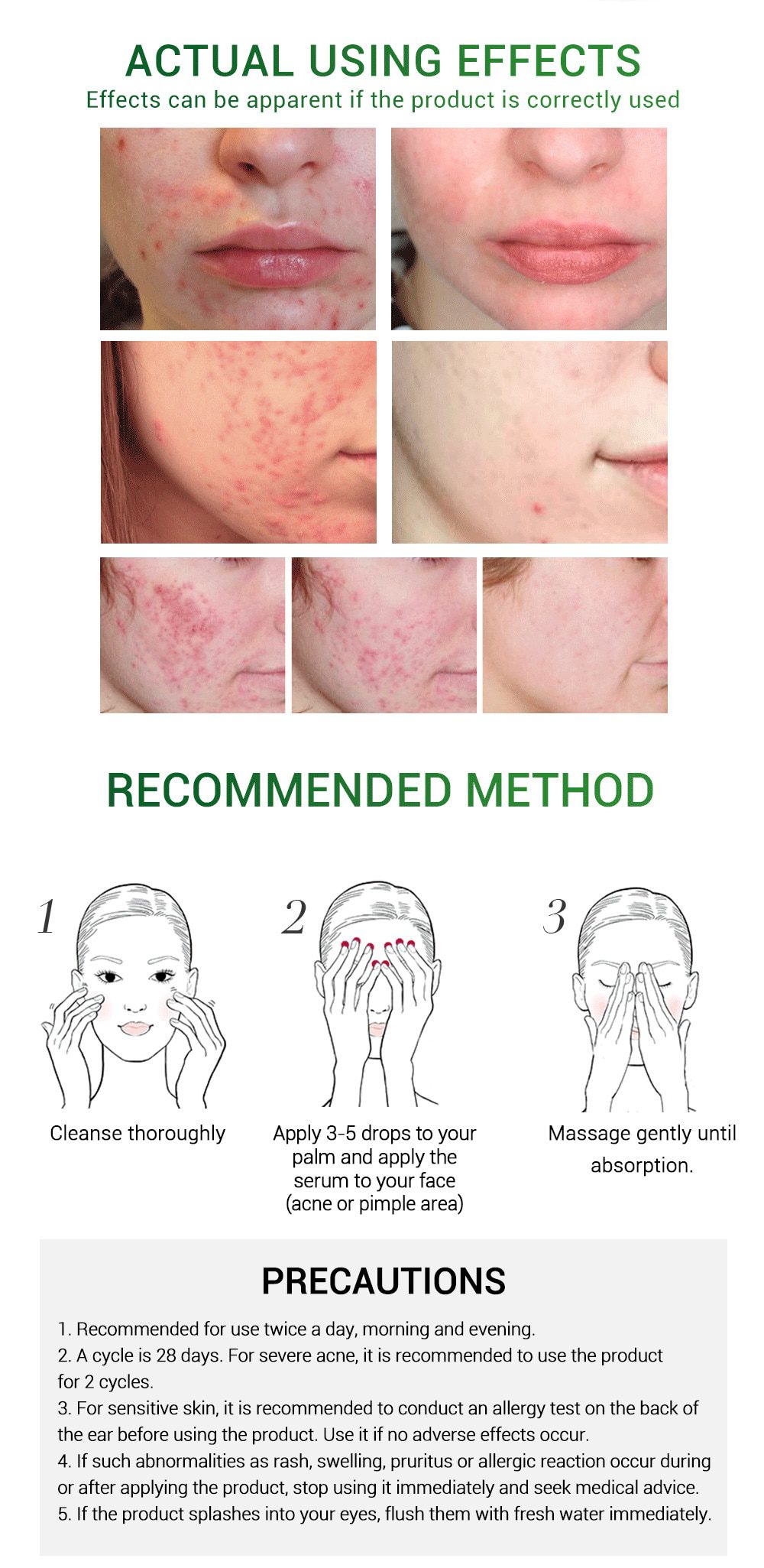 BREYLEE Acne Pimple Patch Face Mask Skin Care Acne Treatment Serum Face Cream Acne Cream Essence Sheet Mask Facial Care Tools BREYLEE Acne Pimple Patch Face Mask Skin Care Acne Treatment Serum Face Cream Acne Cream Essence Sheet Mask Facial Care Tools