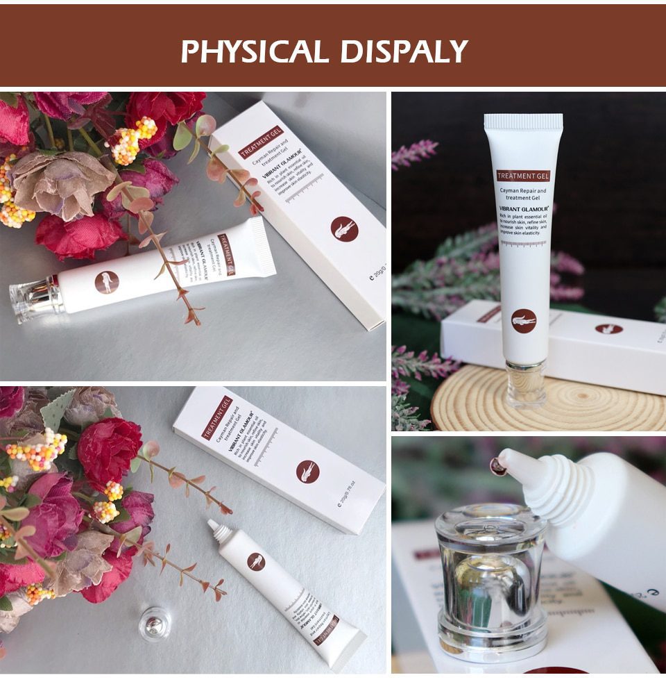 VIBRANT GLAMOUR Repair Scar Removal Cream Acne Scars Gel Stretch Marks Surgical Scar Burn For Body Pigmentation Corrector Care VIBRANT GLAMOUR Repair Scar Removal Cream Acne Scars Gel Stretch Marks Surgical Scar Burn For Body Pigmentation Corrector Care