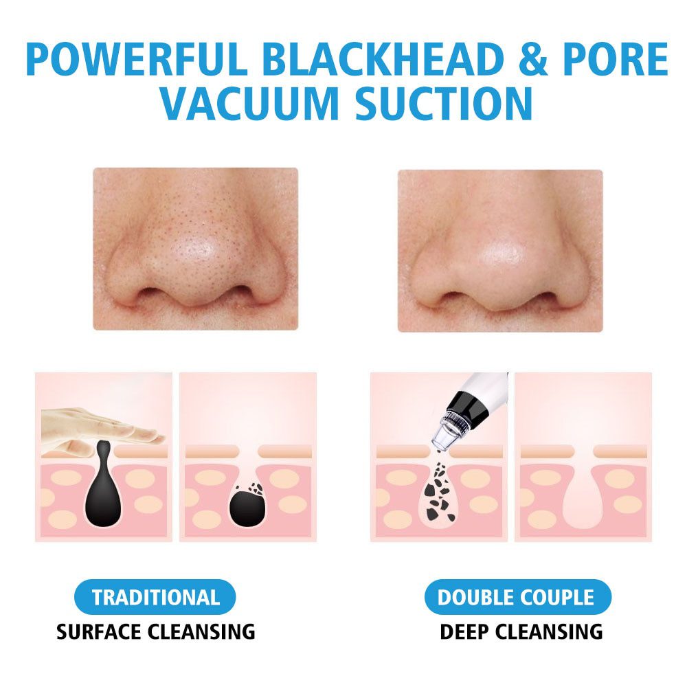 Blackhead Remover Vacuum Pore Cleaner Electric Nose Face Deep Cleansing Skin Care Machine Birthday Gift Dropshipping Beauty Tool Blackhead Remover Vacuum Pore Cleaner Electric Nose Face Deep Cleansing Skin Care Machine Birthday Gift Dropshipping Beauty Tool
