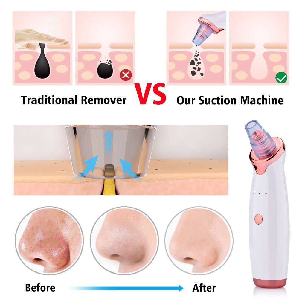 Blackhead Remover Vacuum Pore Cleaner Electric Nose Face Deep Cleansing Skin Care Machine Birthday Gift Dropshipping Beauty Tool Blackhead Remover Vacuum Pore Cleaner Electric Nose Face Deep Cleansing Skin Care Machine Birthday Gift Dropshipping Beauty Tool