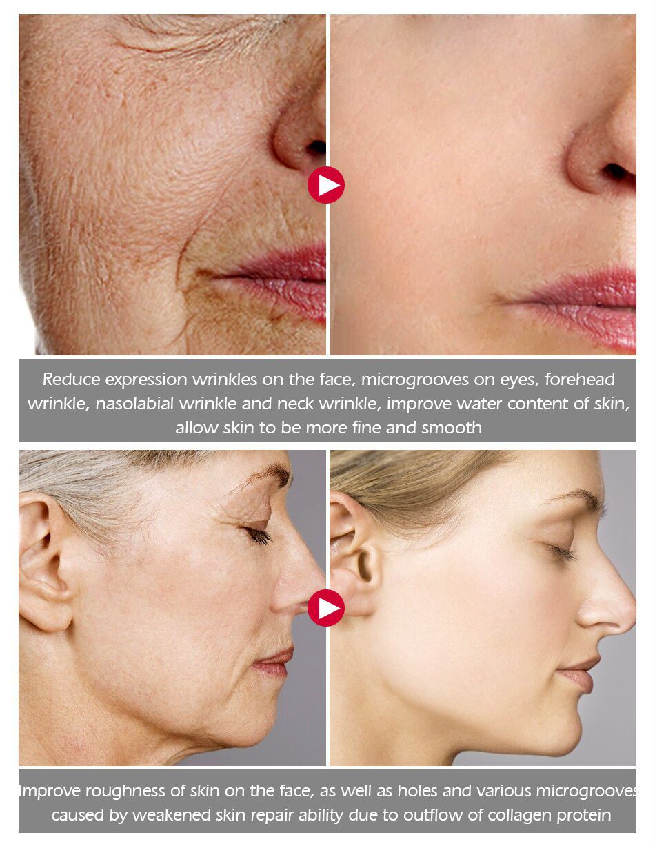 VIBRANT GLAMOUR  Argireline Pure Collagen Face Cream Anti Aging wrinkle Firming  Anti Acne Whitening Moisturizing for women 30g