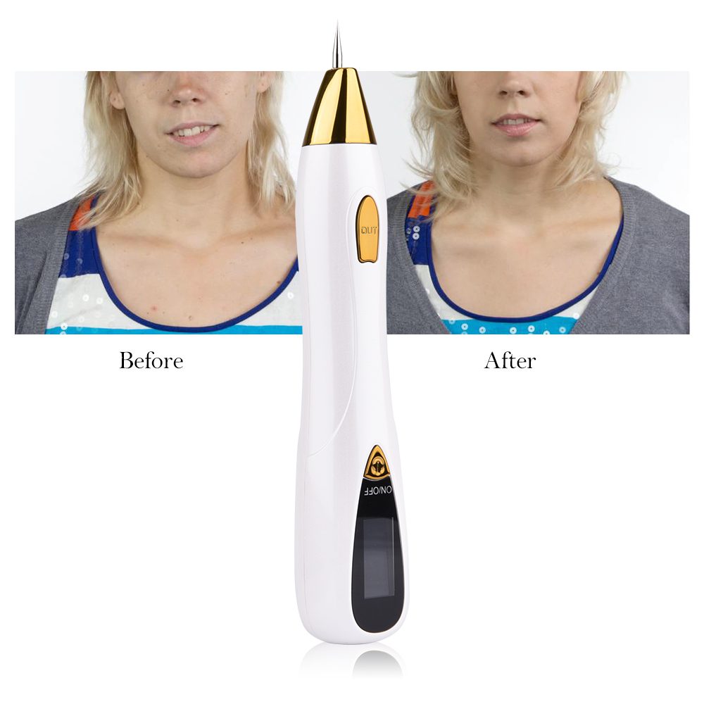 Skin Care Laser Mole Tattoo Freckle Removal Pen LCD Sweep Spot Mole Removing Wart Corns Dark Spot Remover Salon Beauty Machine Skin Care Laser Mole Tattoo Freckle Removal Pen LCD Sweep Spot Mole Removing Wart Corns Dark Spot Remover Salon Beauty Machine