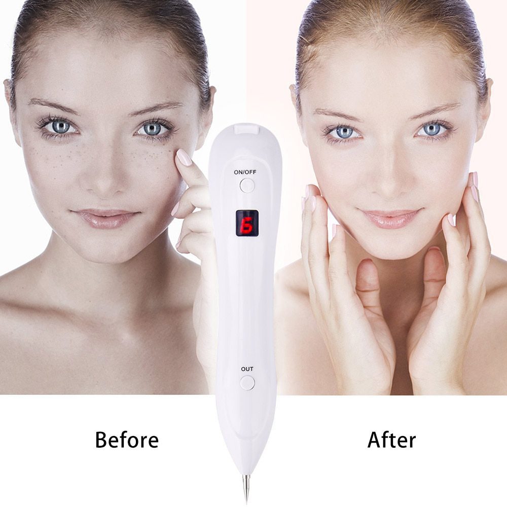 Skin Care Laser Mole Tattoo Freckle Removal Pen LCD Sweep Spot Mole Removing Wart Corns Dark Spot Remover Salon Beauty Machine Skin Care Laser Mole Tattoo Freckle Removal Pen LCD Sweep Spot Mole Removing Wart Corns Dark Spot Remover Salon Beauty Machine