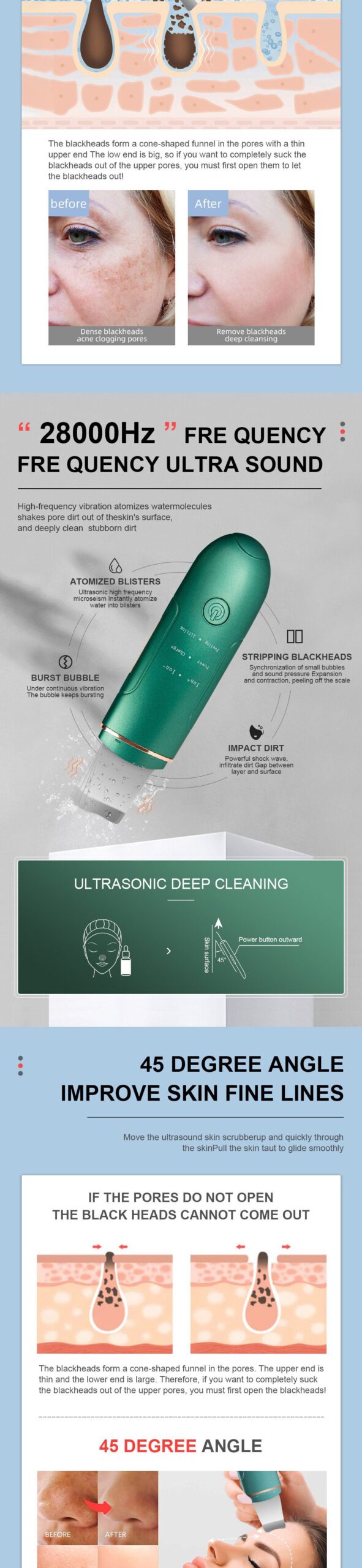 Ultrasonic Skin Scrubber Facial Cleansing Peeling Machine Blackhead Remover Pore Cleaner EMS LED Anti Aging Facial Massager EMS Ultrasonic Skin Scrubber Facial Cleansing Peeling Machine Blackhead Remover Pore Cleaner EMS LED Anti Aging Facial Massager EMS