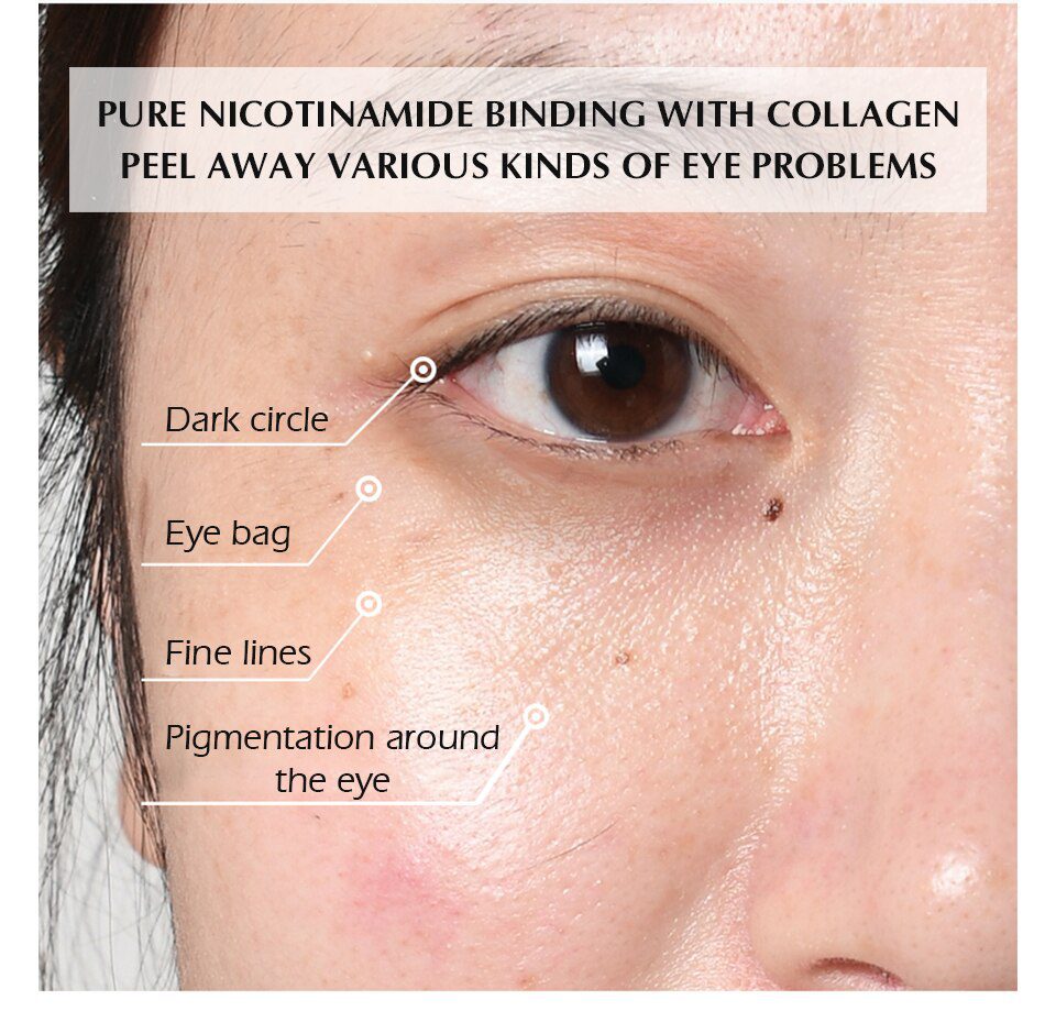 MEIKING Eye Patches 60 Pcs Hyaluronic Acid Nicotinamide Remover Dark Circles Anti-wrinkle Mask Under The Eyes Of Korea MEIKING Eye Patches 60 Pcs Hyaluronic Acid Nicotinamide Remover Dark Circles Anti-wrinkle Mask Under The Eyes Of Korea