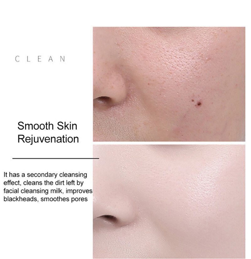24K Gold Niacinamide Face Essence Moisturizing Anti-aging&Wrinkle Hyaluronic Acid Serum Shrinks Pores Repairs Dry Loose Skin 24K Gold Niacinamide Face Essence Moisturizing Anti-aging&Wrinkle Hyaluronic Acid Serum Shrinks Pores Repairs Dry Loose Skin