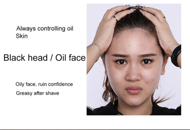 24K Gold Niacinamide Face Essence Moisturizing Anti-aging&Wrinkle Hyaluronic Acid Serum Shrinks Pores Repairs Dry Loose Skin 24K Gold Niacinamide Face Essence Moisturizing Anti-aging&Wrinkle Hyaluronic Acid Serum Shrinks Pores Repairs Dry Loose Skin