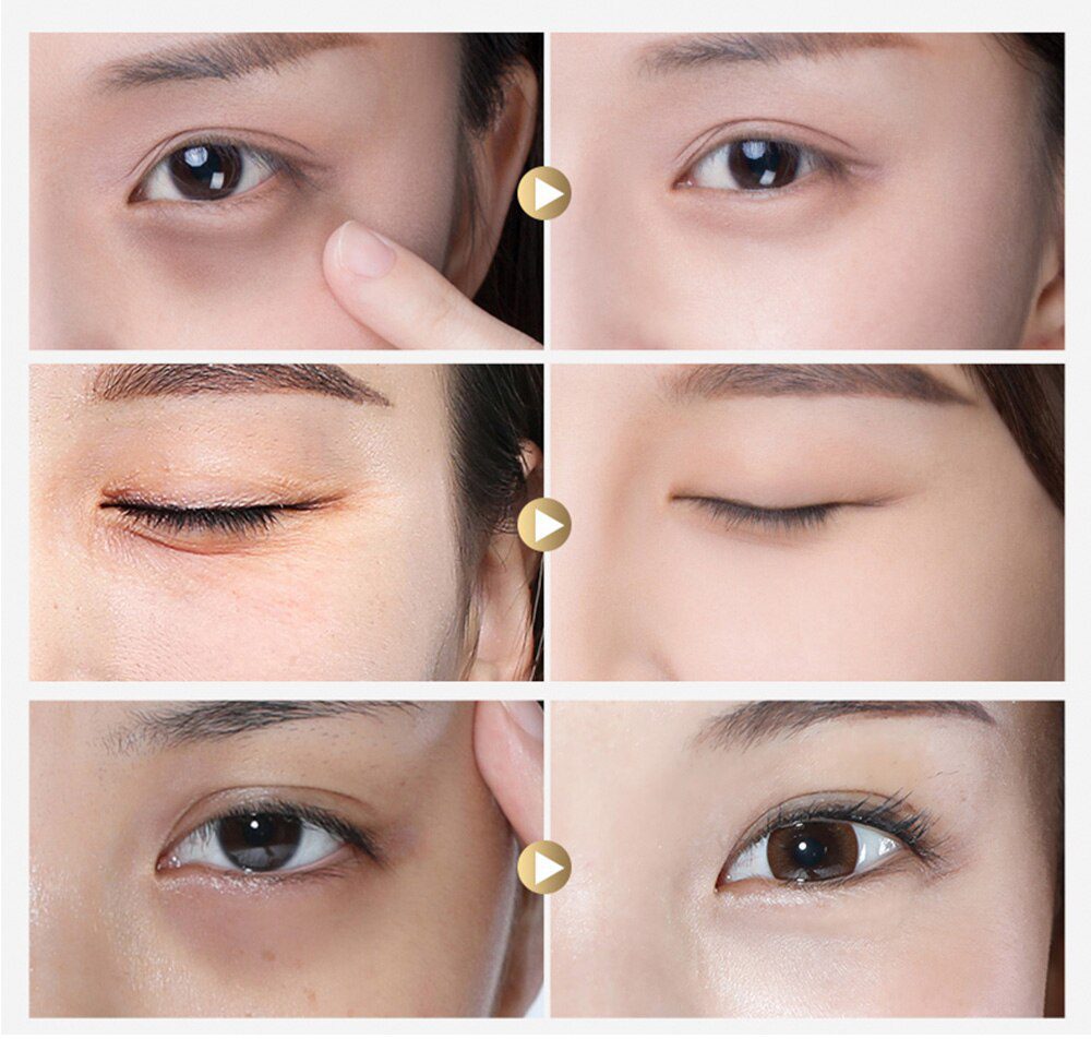 LANBENA Eye Mask Collagen Eye Patch Skin Care Hyaluronic Acid Gel Moisturizing Retinol Anti Aging Remove Dark Circles Eye Bag LANBENA Eye Mask Collagen Eye Patch Skin Care Hyaluronic Acid Gel Moisturizing Retinol Anti Aging Remove Dark Circles Eye Bag