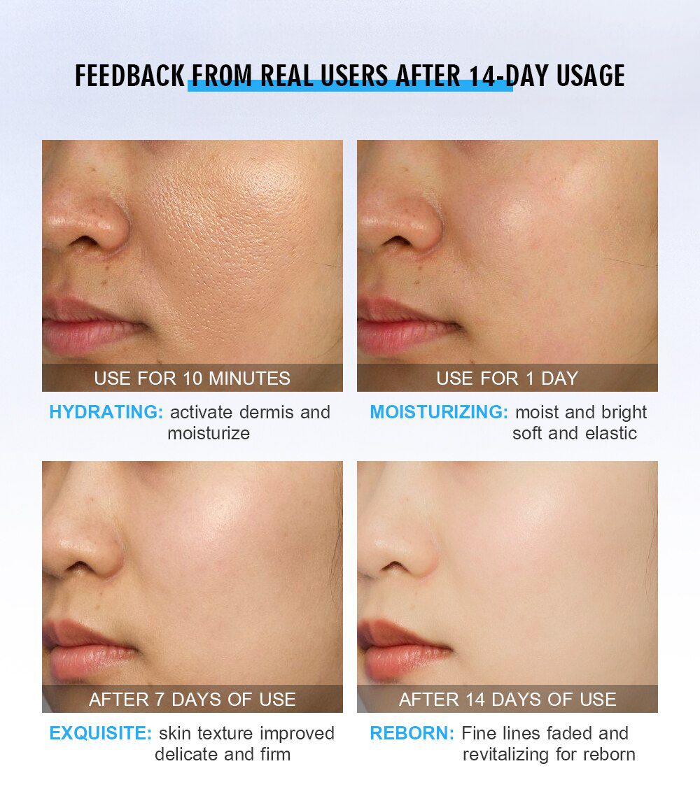 VIBRANT GLAMOUR Hyaluronic Acid Face Serum Moisturizing Shrink Pores Remove Fine Lines Anti-Aging Anti-Wrinkle Deep Care 30ml VIBRANT GLAMOUR Hyaluronic Acid Face Serum Moisturizing Shrink Pores Remove Fine Lines Anti-Aging Anti-Wrinkle Deep Care 30ml