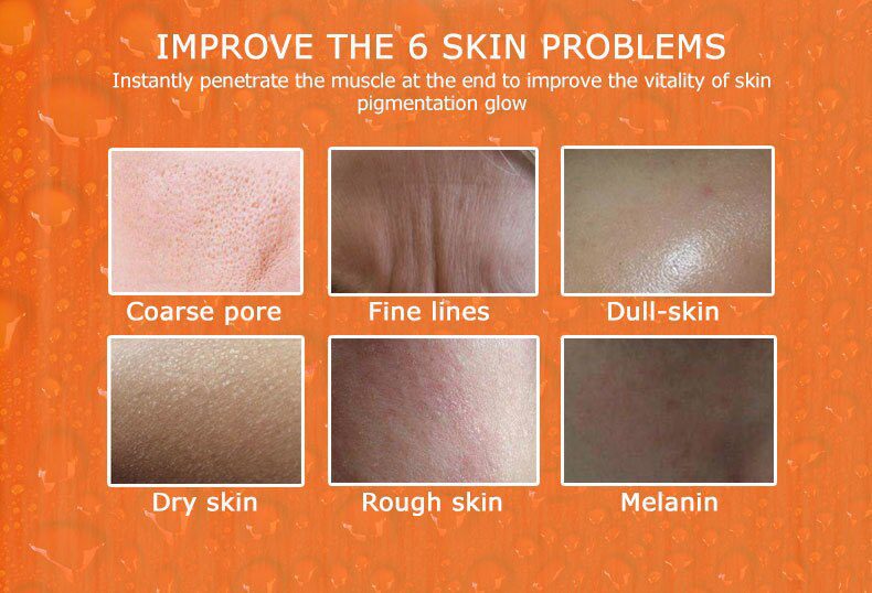 ARTISCARE serum for face whitening anti winkles 8pcs/lot hyaluronic acid essence vitamin c serum facial acne treatment skin care ARTISCARE serum for face whitening anti winkles 8pcs/lot hyaluronic acid essence vitamin c serum facial acne treatment skin care