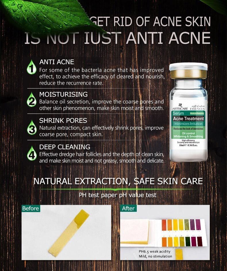 ARTISCARE serum for face whitening anti winkles 8pcs/lot hyaluronic acid essence vitamin c serum facial acne treatment skin care ARTISCARE serum for face whitening anti winkles 8pcs/lot hyaluronic acid essence vitamin c serum facial acne treatment skin care