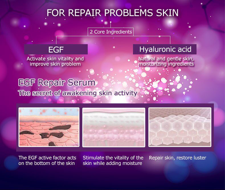 ARTISCARE serum for face whitening anti winkles 8pcs/lot hyaluronic acid essence vitamin c serum facial acne treatment skin care ARTISCARE serum for face whitening anti winkles 8pcs/lot hyaluronic acid essence vitamin c serum facial acne treatment skin care