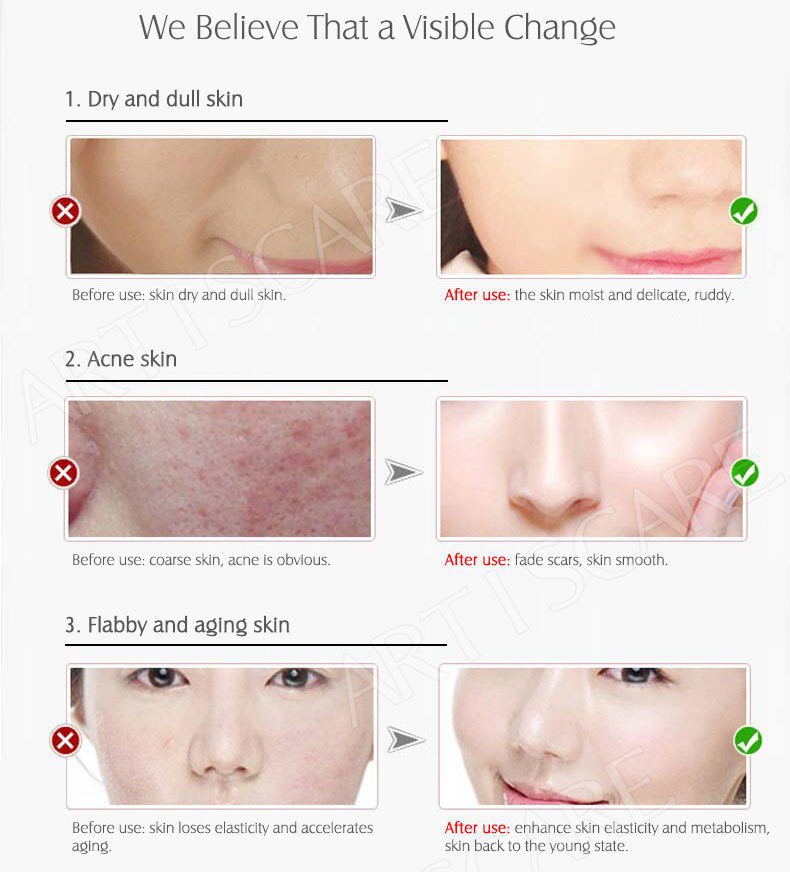 ARTISCARE Vitamin C Serum+Six Peptides Serum 24K Gold+Hyaluronic Acid Serum Anti-Aging Moisturizing Skin Care Whitening Brighten ARTISCARE Vitamin C Serum+Six Peptides Serum 24K Gold+Hyaluronic Acid Serum Anti-Aging Moisturizing Skin Care Whitening Brighten