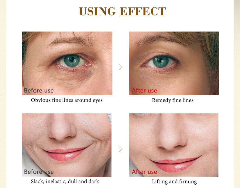 ARTISCARE Vitamin C Serum+Six Peptides Serum 24K Gold+Hyaluronic Acid Serum Anti-Aging Moisturizing Skin Care Whitening Brighten ARTISCARE Vitamin C Serum+Six Peptides Serum 24K Gold+Hyaluronic Acid Serum Anti-Aging Moisturizing Skin Care Whitening Brighten