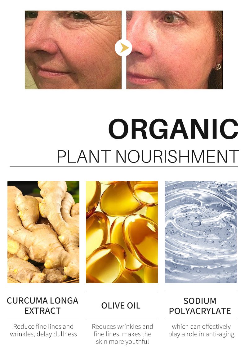Turmeric Lemon Oil Skin Glow To Lightening Acne Dark Patches, Acne Bright Skin Dark Spot Corrector Face Whitening Serum Turmeric Lemon Oil Skin Glow To Lightening Acne Dark Patches, Acne Bright Skin Dark Spot Corrector Face Whitening Serum