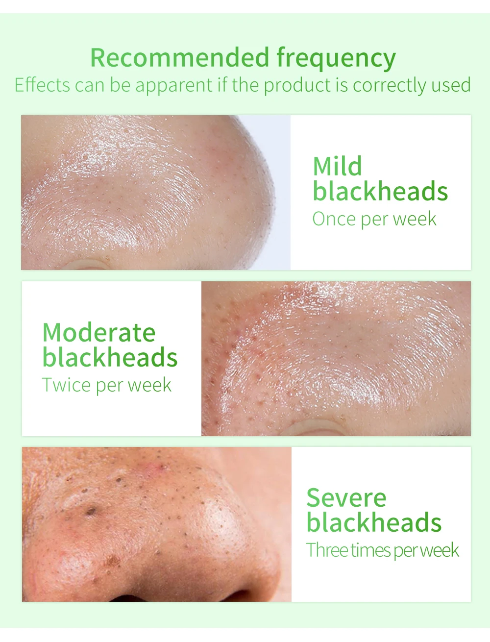 LANBENA Blackhead Remover Mask Serum Shrink Pores Acne Treatment Essence Deep Cleaning Purifying Smooth Skin Care Beauty 100pcs LANBENA Blackhead Remover Mask Serum Shrink Pores Acne Treatment Essence Deep Cleaning Purifying Smooth Skin Care Beauty 100pcs