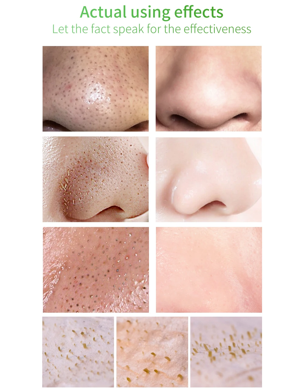 LANBENA Blackhead Remover Mask Serum Shrink Pores Acne Treatment Essence Deep Cleaning Purifying Smooth Skin Care Beauty 100pcs LANBENA Blackhead Remover Mask Serum Shrink Pores Acne Treatment Essence Deep Cleaning Purifying Smooth Skin Care Beauty 100pcs