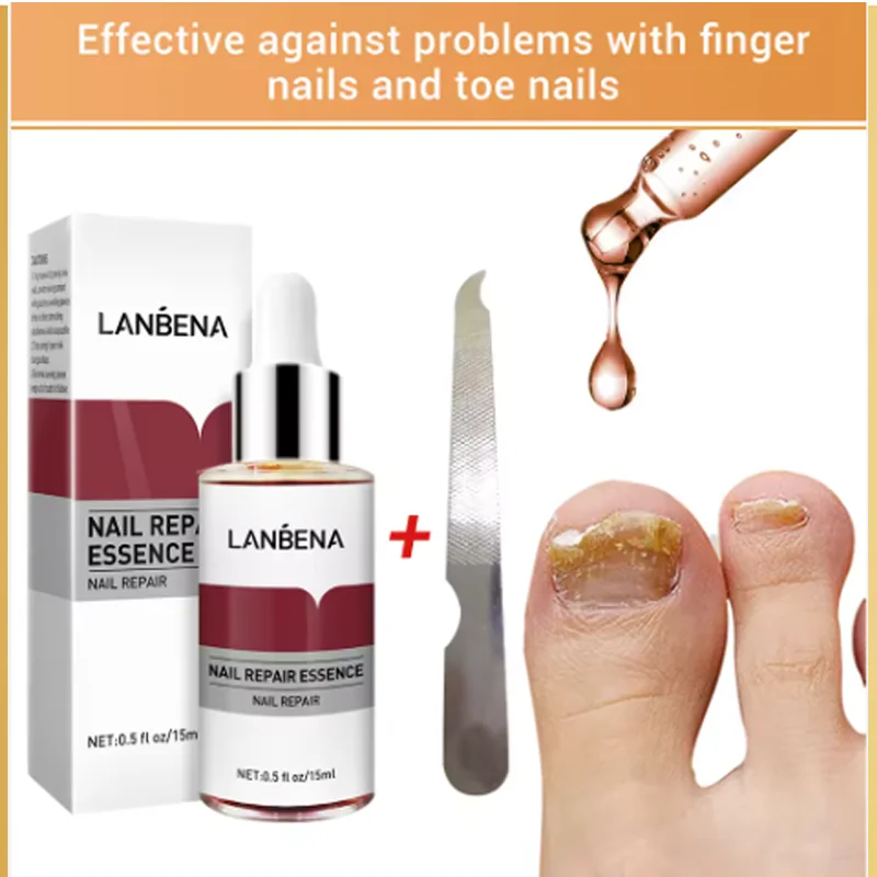 LANBENA Fungus Care Remove Onychomycosis Toes Nourish Brighten Hands Feet Product Repair Suitable Women Nail Pepair Essencs LANBENA Fungus Care Remove Onychomycosis Toes Nourish Brighten Hands Feet Product Repair Suitable Women Nail Pepair Essencs
