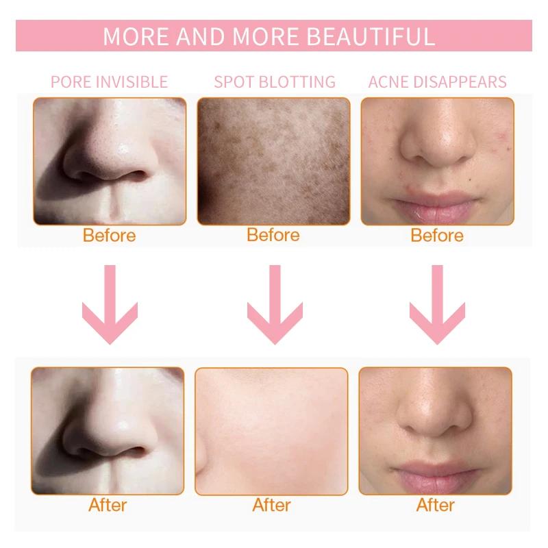 Led Face and Neck Mask Beauty Electric Face Mask for Woman Man 7 Colors Light LED Mask Facial Skin Care Repair Skin Whitening