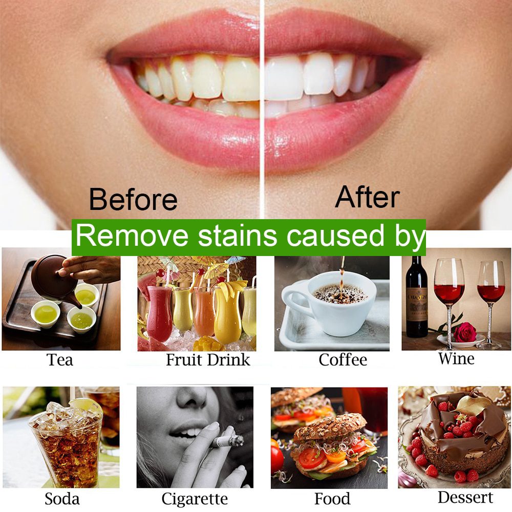 OSHIONER 30g Teeth Whitening Oral Care Charcoal Powder Natural Activated Charcoal Teeth Whitener Powder Oral Hygiene OSHIONER 30g Teeth Whitening Oral Care Charcoal Powder Natural Activated Charcoal Teeth Whitener Powder Oral Hygiene