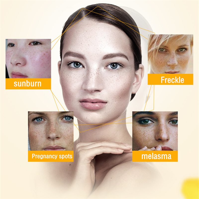 Dimollaure Strong effect whitening cream +Kojic acid serum Remove Freckle melasma pigment Melanin sunburn Acne scars brown Spot Dimollaure Strong effect whitening cream +Kojic acid serum Remove Freckle melasma pigment Melanin sunburn Acne scars brown Spot