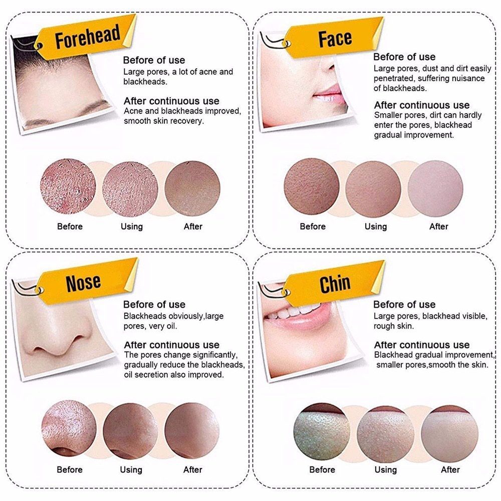 Mabox Black Mask Peel Off Bamboo Charcoal Purifying Blackhead Remover Mask Deep Cleansing for AcneScars Blemishes WrinklesFacial Mabox Black Mask Peel Off Bamboo Charcoal Purifying Blackhead Remover Mask Deep Cleansing for AcneScars Blemishes WrinklesFacial