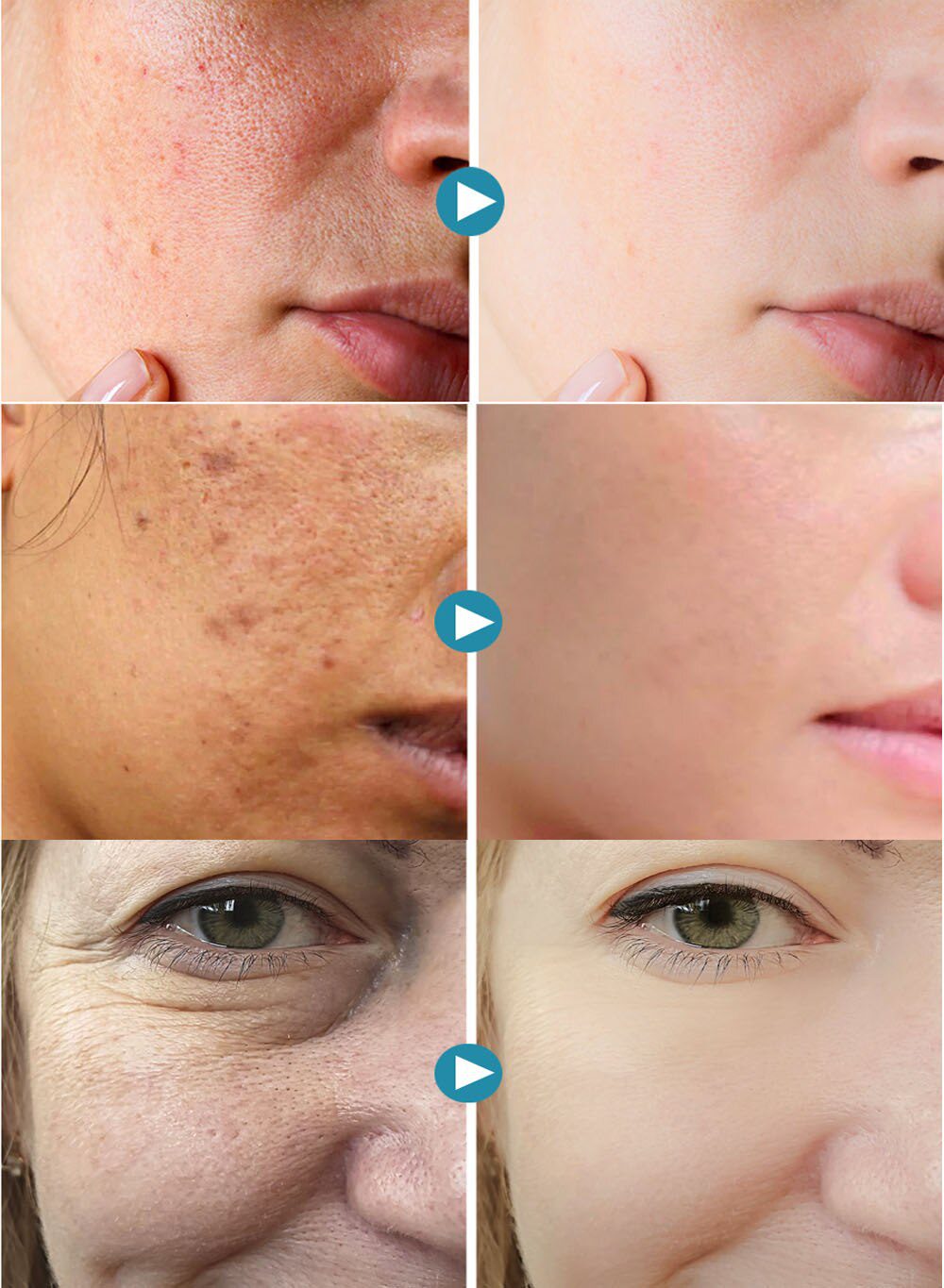 Lactobionic Acid Face Serum Anti-Aging Wrinkles Essence Exfoliating Shrink Pores Anti-Oxidation Lift Firming Remove Fine Lines Lactobionic Acid Face Serum Anti-Aging Wrinkles Essence Exfoliating Shrink Pores Anti-Oxidation Lift Firming Remove Fine Lines