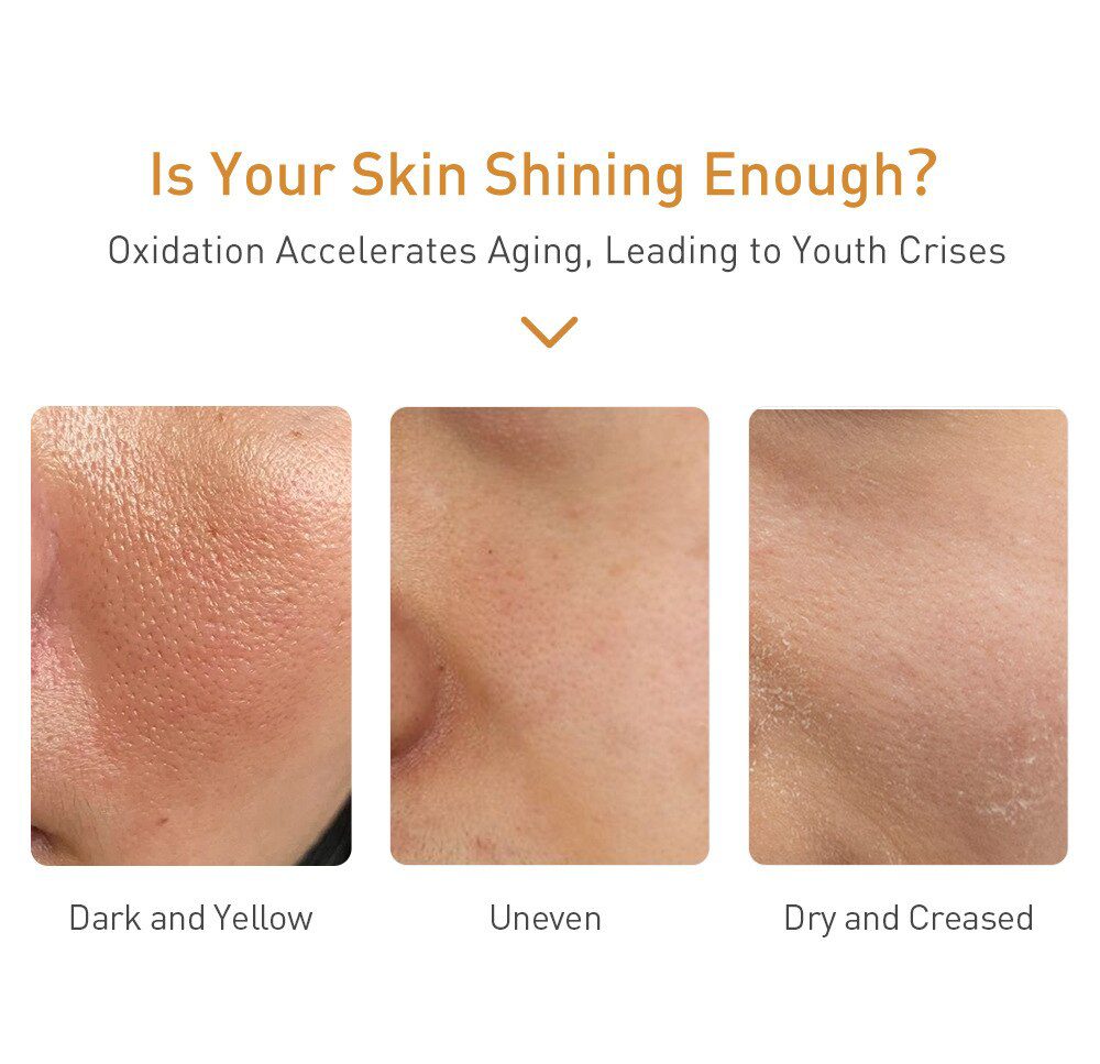 LANBENA Vitamin C Whitening Face Serum Lighten Spots Brightening Facial Skin Essence Fade Dark Spots Remove Freckle Speckle Care LANBENA Vitamin C Whitening Face Serum Lighten Spots Brightening Facial Skin Essence Fade Dark Spots Remove Freckle Speckle Care