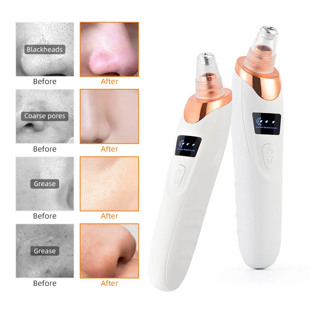 Vacuum Nose Blackhead Remover Face Cleansing Beauty Machine Facial Suction Cleaner Pimple Dead Skin Remover Extractor Skin Care Vacuum Nose Blackhead Remover Face Cleansing Beauty Machine Facial Suction Cleaner Pimple Dead Skin Remover Extractor Skin Care